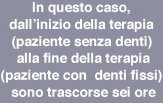Chirurgia Implantare Guidata